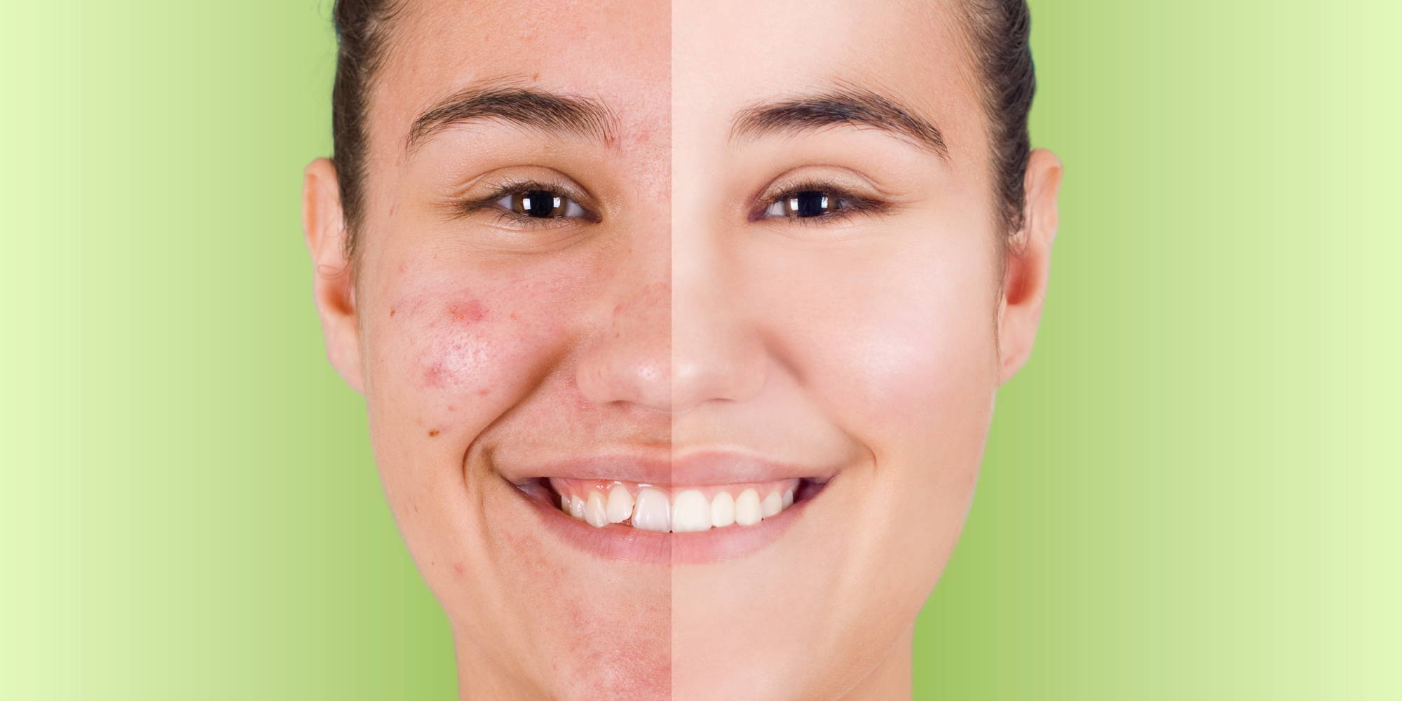 Soly Skin Black Tea Face Mask II